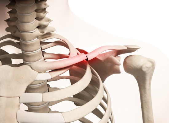 Collarbone &#8211; structure, injuries, fractures, tumors. Treatment of collarbone injuries