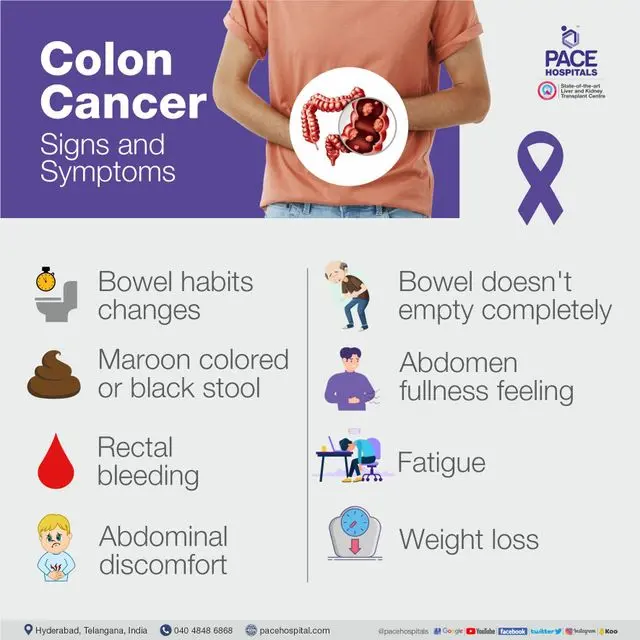 Colon cancer &#8211; first symptoms, causes, inheritance