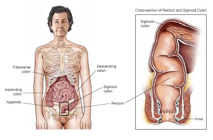 Colonoscopy &#8211; the best method to detect a cancer of the digestive system. What is conducive to cancer?