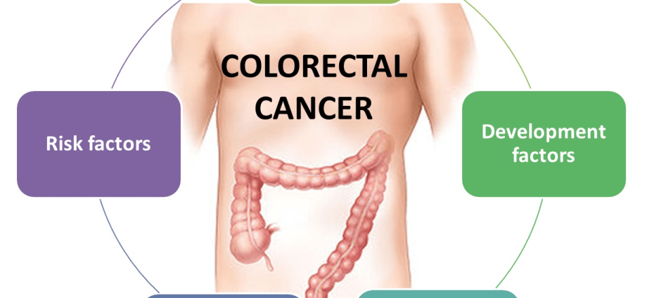 Colorectal cancer is the second most common cancer in Poland. «When symptoms appear, there is little the doctor can do»