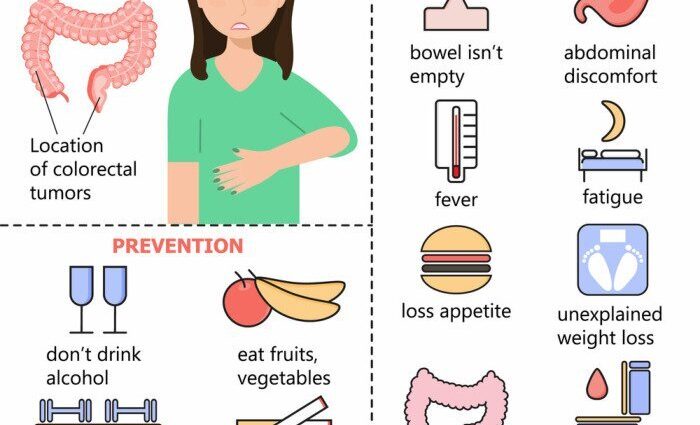 Colorectal cancer &#8211; what are the symptoms? [INFOGRAPHICS]