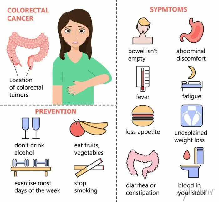 Colorectal cancer &#8211; what are the symptoms? [INFOGRAPHICS]