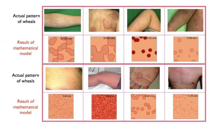 Common skin diseases