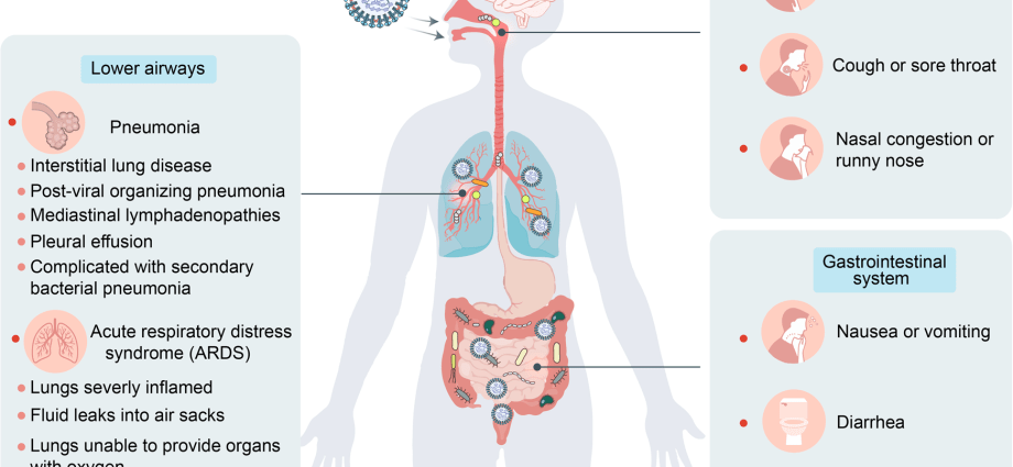 Complications of COVID-19. The organism can attack itself. Even necrosis as a result