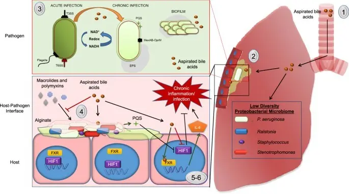 Component of bile associated with the level of risk of respiratory diseases