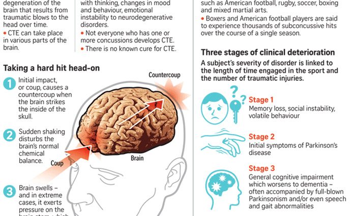 Concussion of the brain &#8211; symptoms, diagnosis. How to proceed in case of suspected concussion?