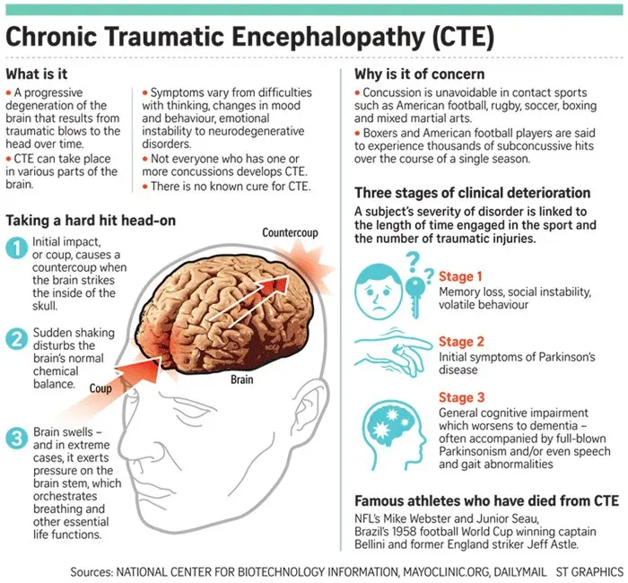 Concussion of the brain &#8211; symptoms, diagnosis. How to proceed in case of suspected concussion?