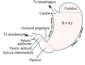 Congenital hypertrophic pyloric stenosis