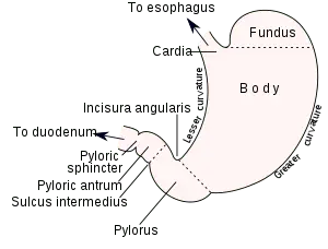 Congenital hypertrophic pyloric stenosis