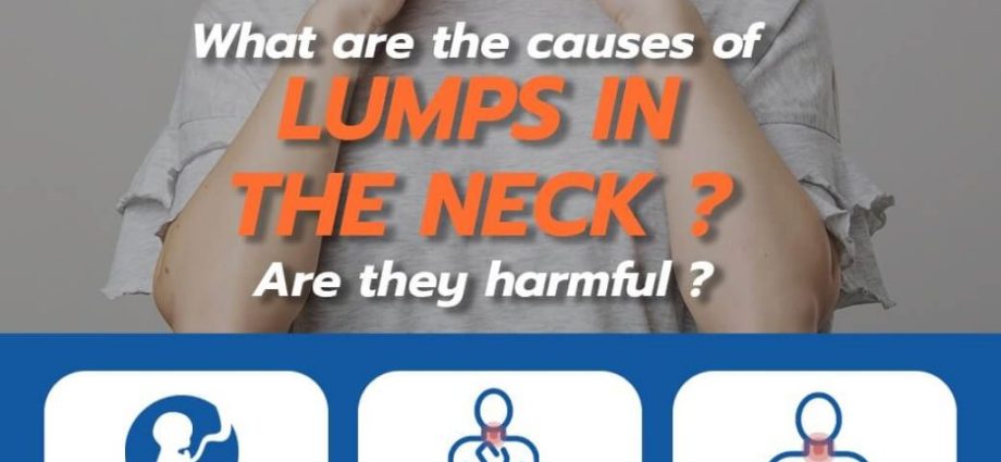 Congenital lumpy changes in the neck