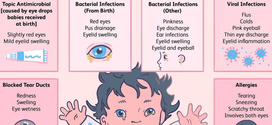 Conjunctivitis in children &#8211; symptoms, causes and treatment