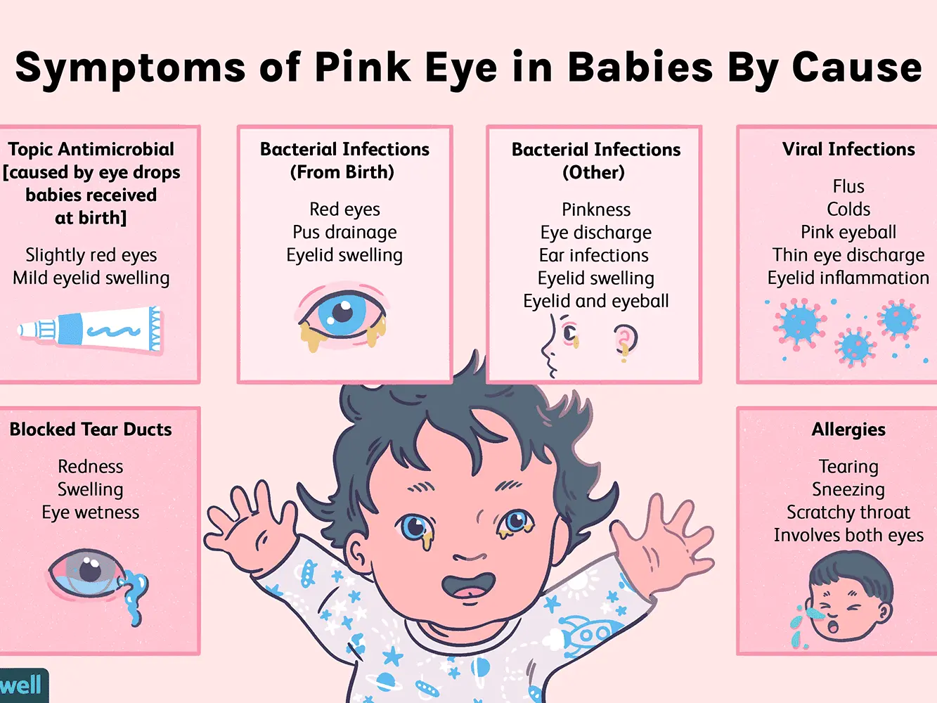 Conjunctivitis in children &#8211; symptoms, causes and treatment