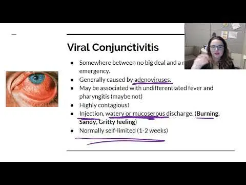 Conjunctivitis &#8211; types. What is the treatment of conjunctivitis? [WE EXPLAIN]