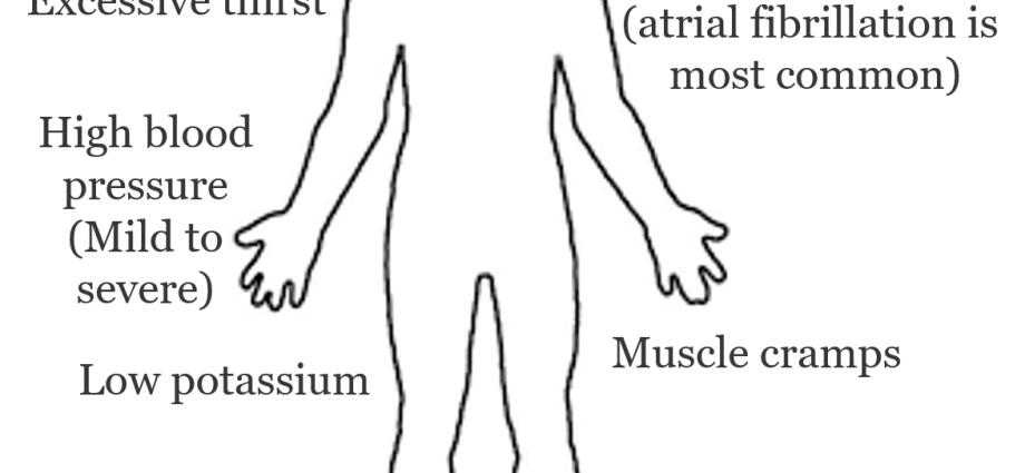 Conn&#8217;s syndrome &#8211; symptoms