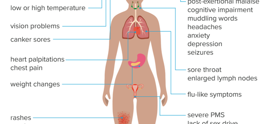 Constant Fatigue &#8211; Symptoms and Treatment