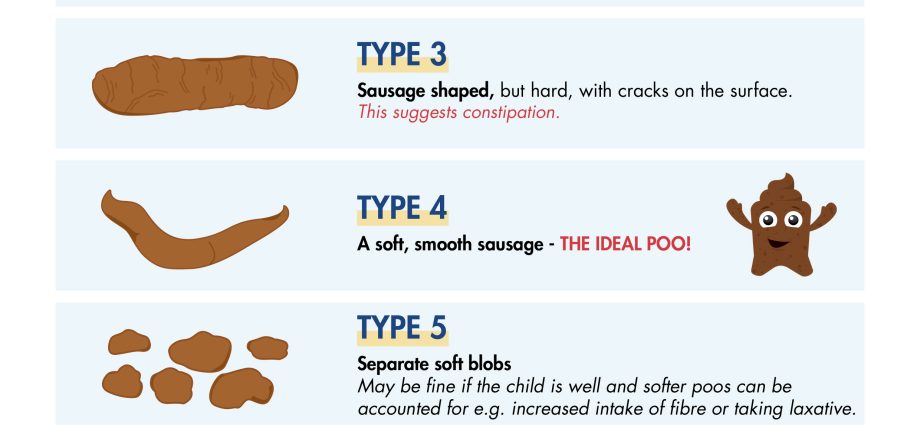 Constipation in a child &#8211; what do they result from?