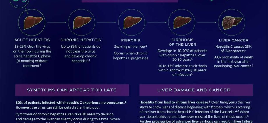 Contact with HCV could have been 90 percent. Poles. The first symptoms even after 30 years