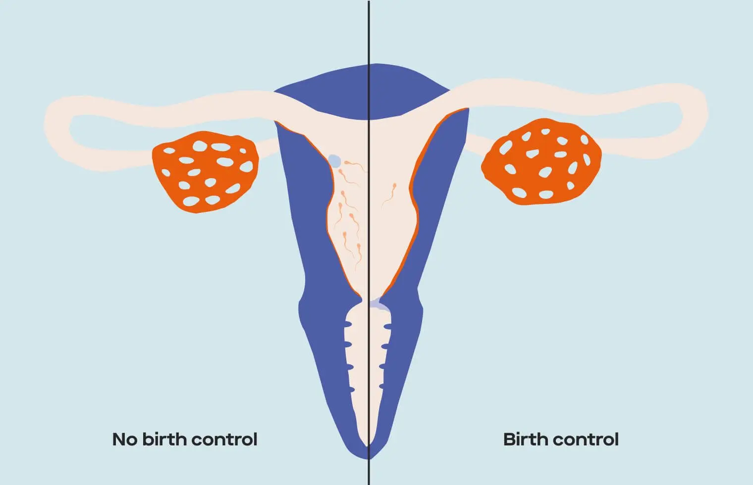 Contraception and pregnancy. How Does Contraception Affect Pregnancy?