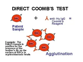 Coombs test &#8211; when to do? PTA in pregnancy