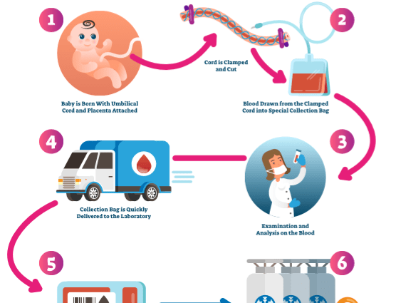 Cord blood &#8211; collection, storage, application. What is an umbilical cord blood bank?