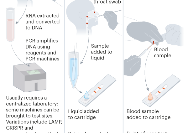 Coronavirus Antigen Tests &#8211; Everything You Need to Know Before You Decide to Do Home Self-Examination