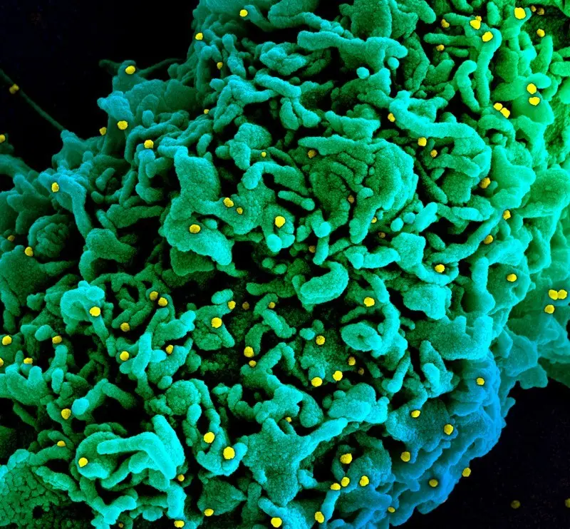Coronavirus can cause diabetes. According to scientists, this is &#8220;highly likely&#8221;