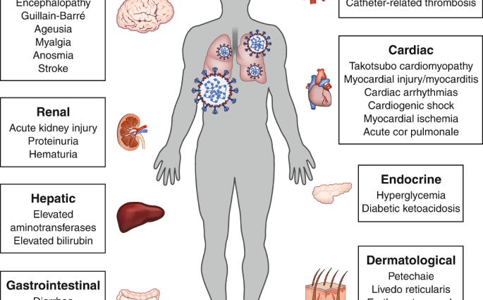 Coronavirus causes acute interstitial pneumonia. Conversation with a pulmonologist