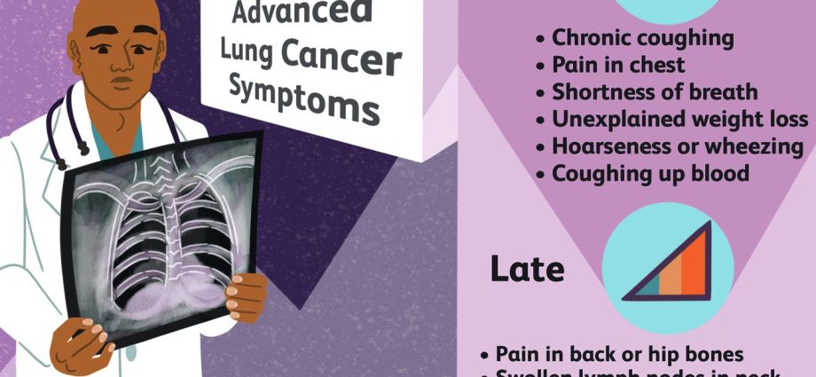 Coughing is the first symptom of lung cancer. Signals are also visible on the face