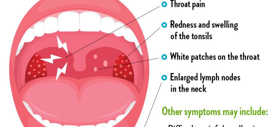 Could a sore throat be a symptom of the coronavirus?