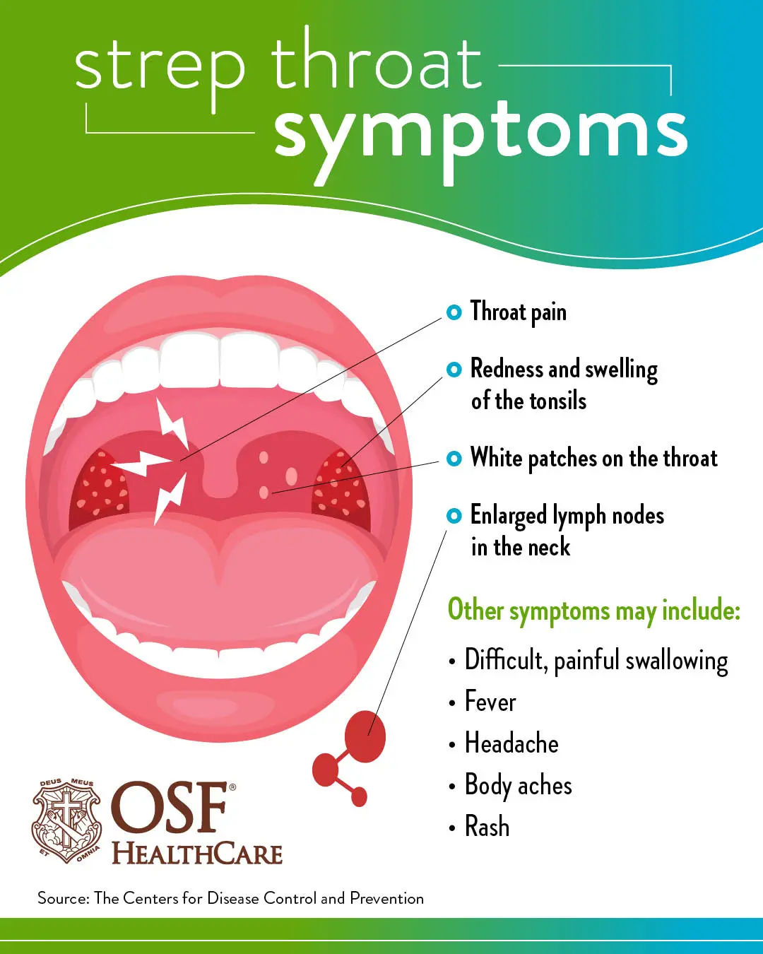 Could a sore throat be a symptom of the coronavirus?