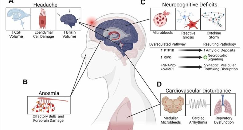 COVID-19 Accelerates Brain Aging? Disturbing information