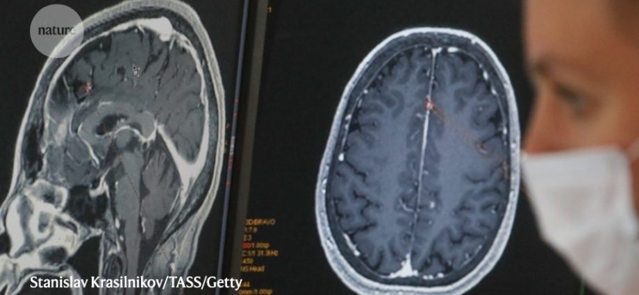 COVID-19 can cause brain tissue loss