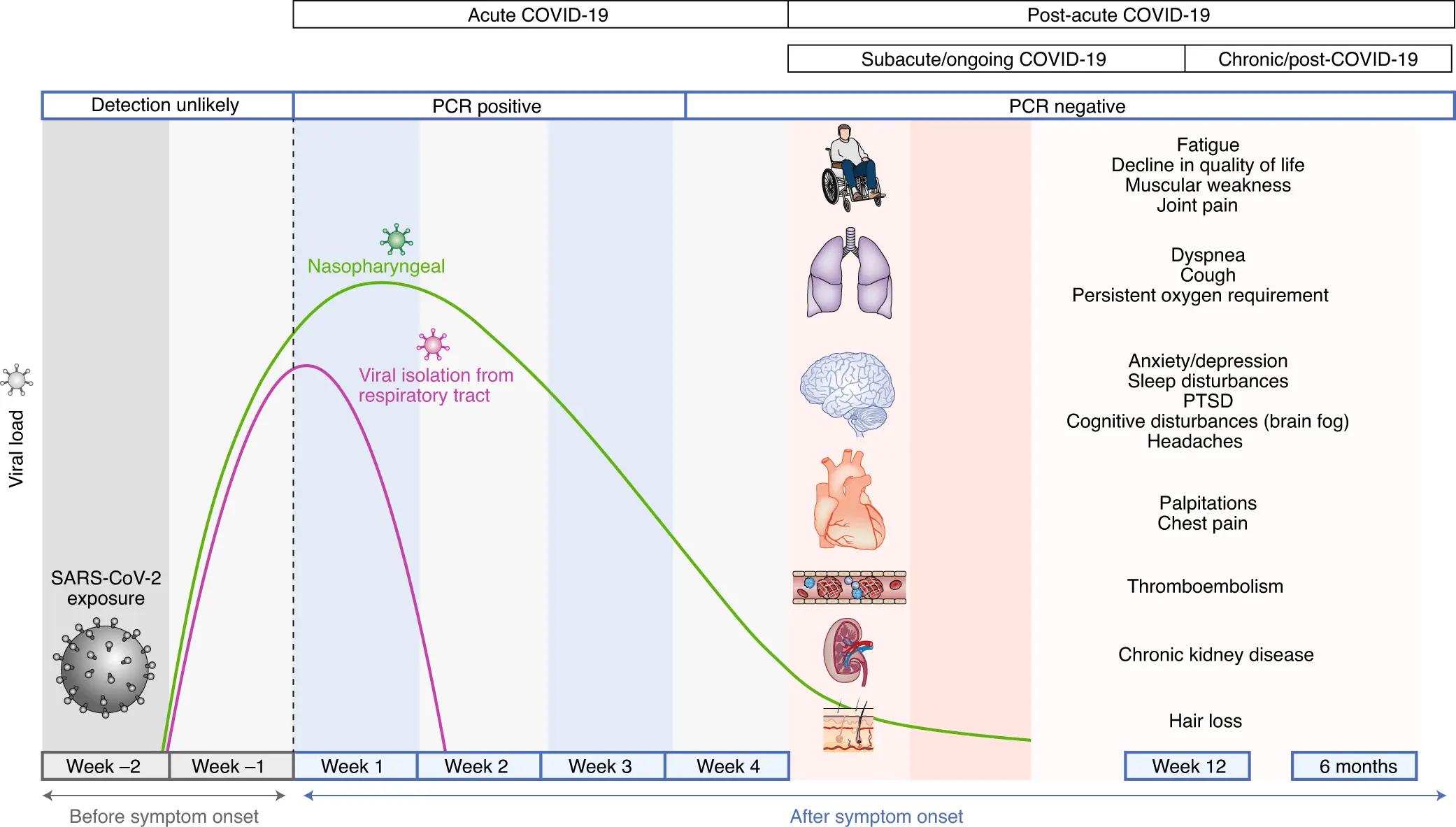 COVID-19 &#8211; causes, symptoms, course, treatment