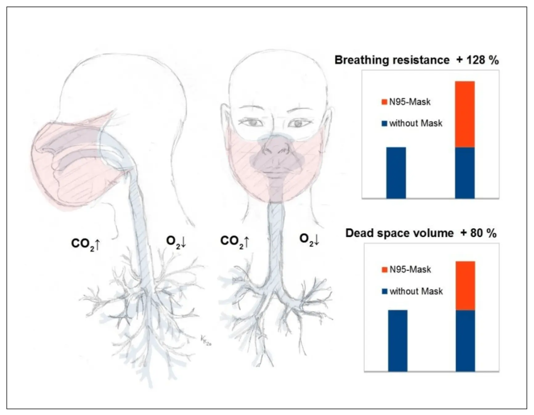 COVID-19 masks can accelerate the development of tooth decay