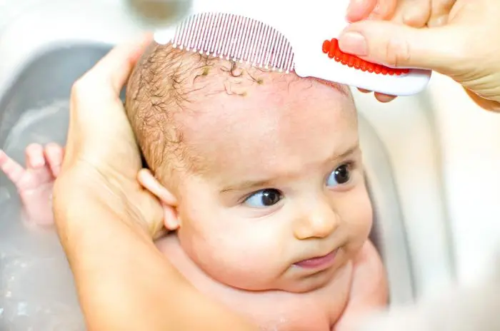 Cradle cap in an infant &#8211; causes, treatment. How to get rid of cradle cap? [WE EXPLAIN]