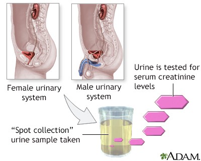 Creatinine in urine &#8211; what does it show?