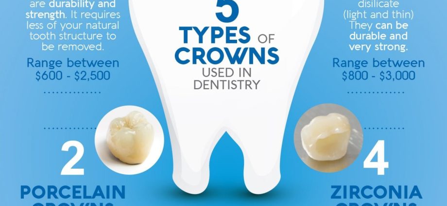 Crowns on implants &#8211; materials, procedure, prices