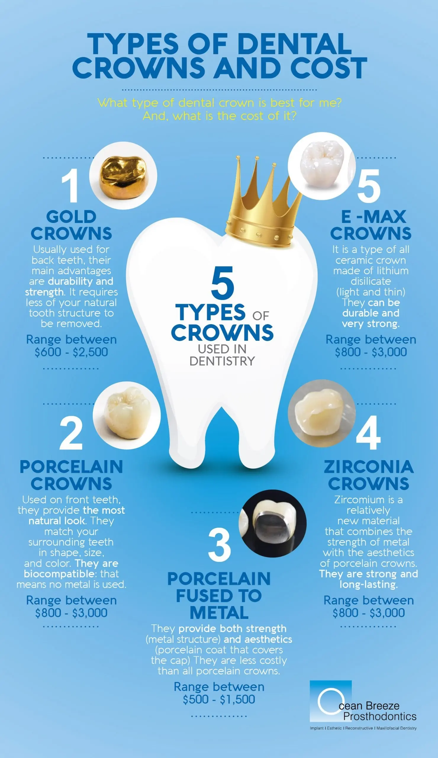 Crowns on implants &#8211; materials, procedure, prices