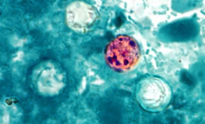 Cyclosporosis