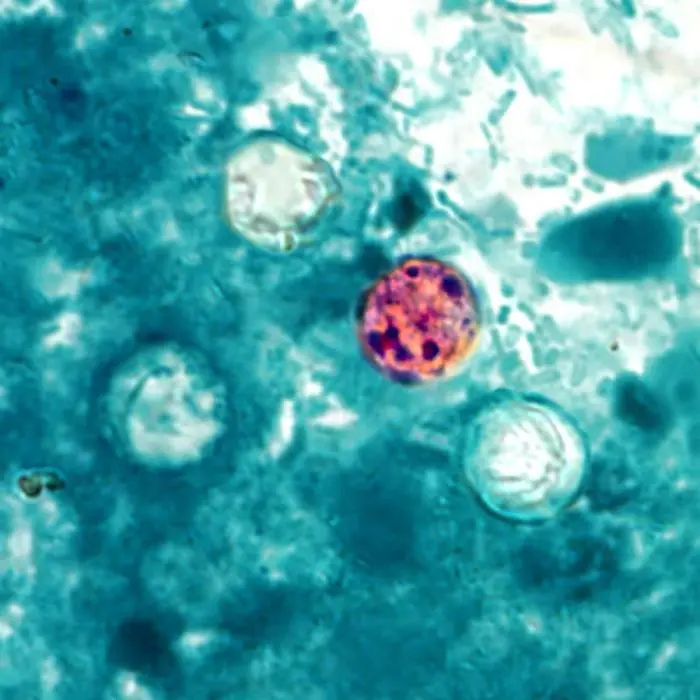 Cyclosporosis