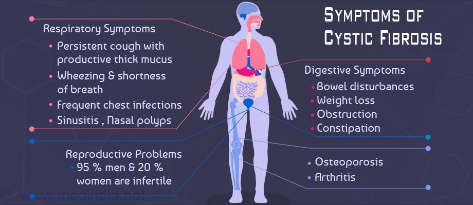 Cystic fibrosis &#8211; symptoms, diagnosis, treatment