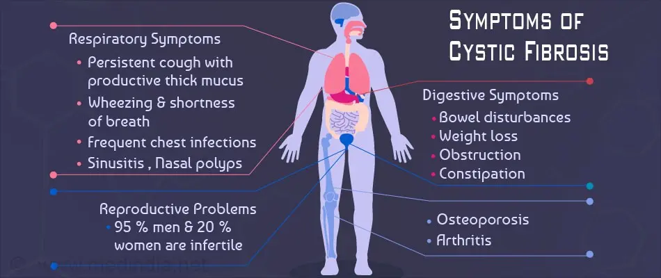 Cystic fibrosis &#8211; symptoms, diagnosis, treatment