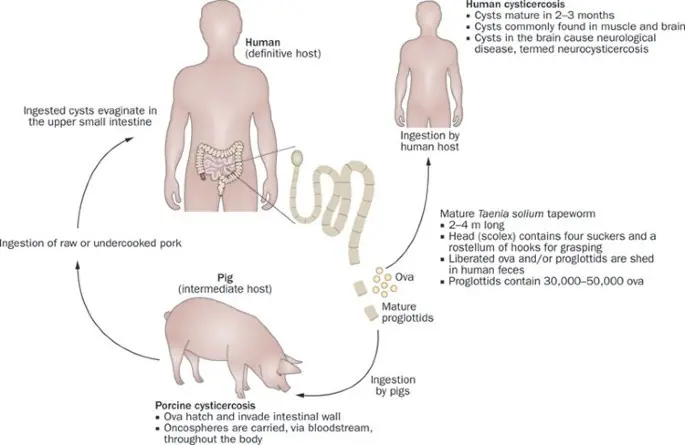 Cysticercosis (cysticercosis) &#8211; symptoms, treatment