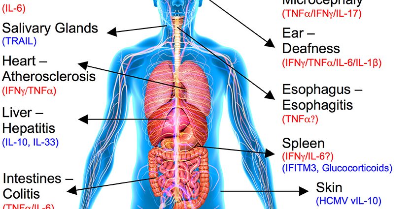 Cytomegalovirus disease caused by cytomegalovirus (CMV)