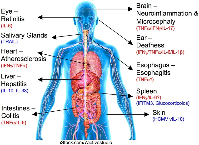 Cytomegalovirus disease caused by cytomegalovirus (CMV)