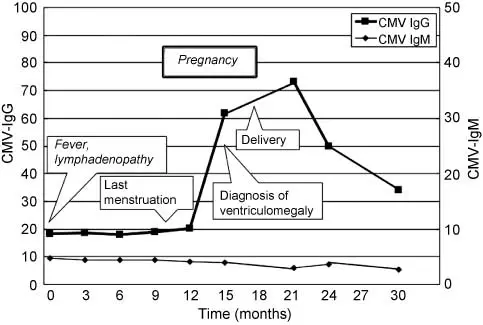 Cytomegaly &#8211; Symptoms and Treatment. IgM IgG results | CMV virus