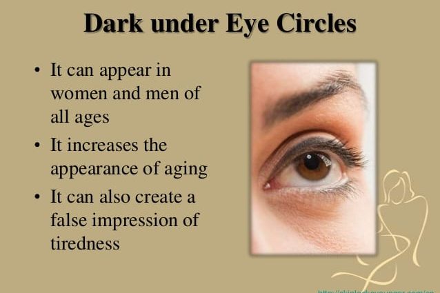 Dark circles under the eyes &#8211; causes and home remedies