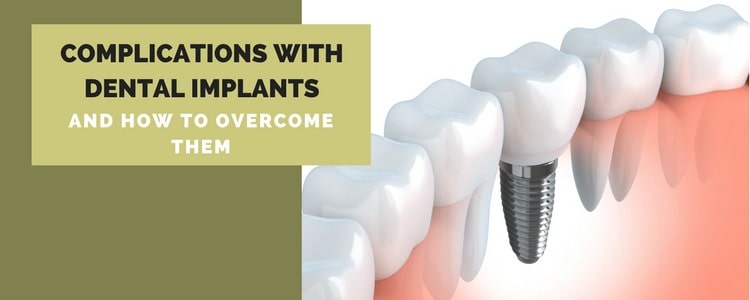 Dental implants &#8211; types and complications. Who can&#8217;t make dental implants?