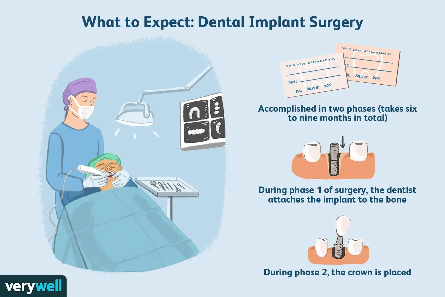 Dental surgery &#8211; treatments, contraindications, convalescence. What does a dental surgeon do?