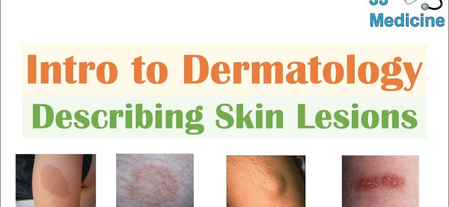 Dermatology &#8211; what does it do? Skin lesions and diseases